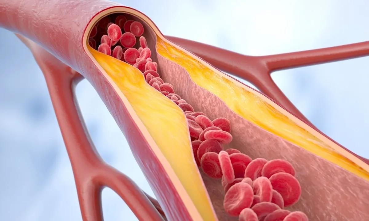 La pastilla diaria reduce los niveles de colesterol 