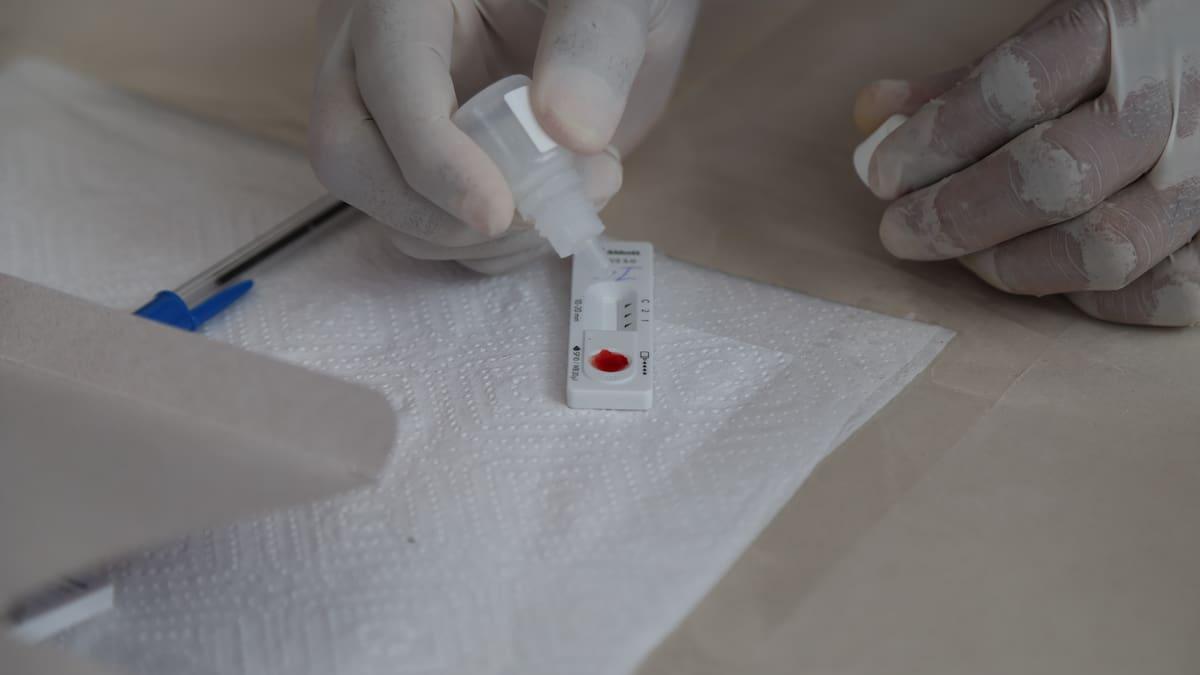 Castilla-La Mancha es una de las comunidades con menor número de casos de sida en España |BE Ciudad Real |Cadena SER