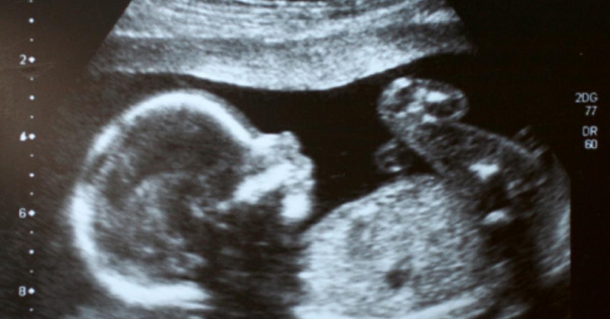 Estos son trastornos mentales que estimulan el abdomen del hogar